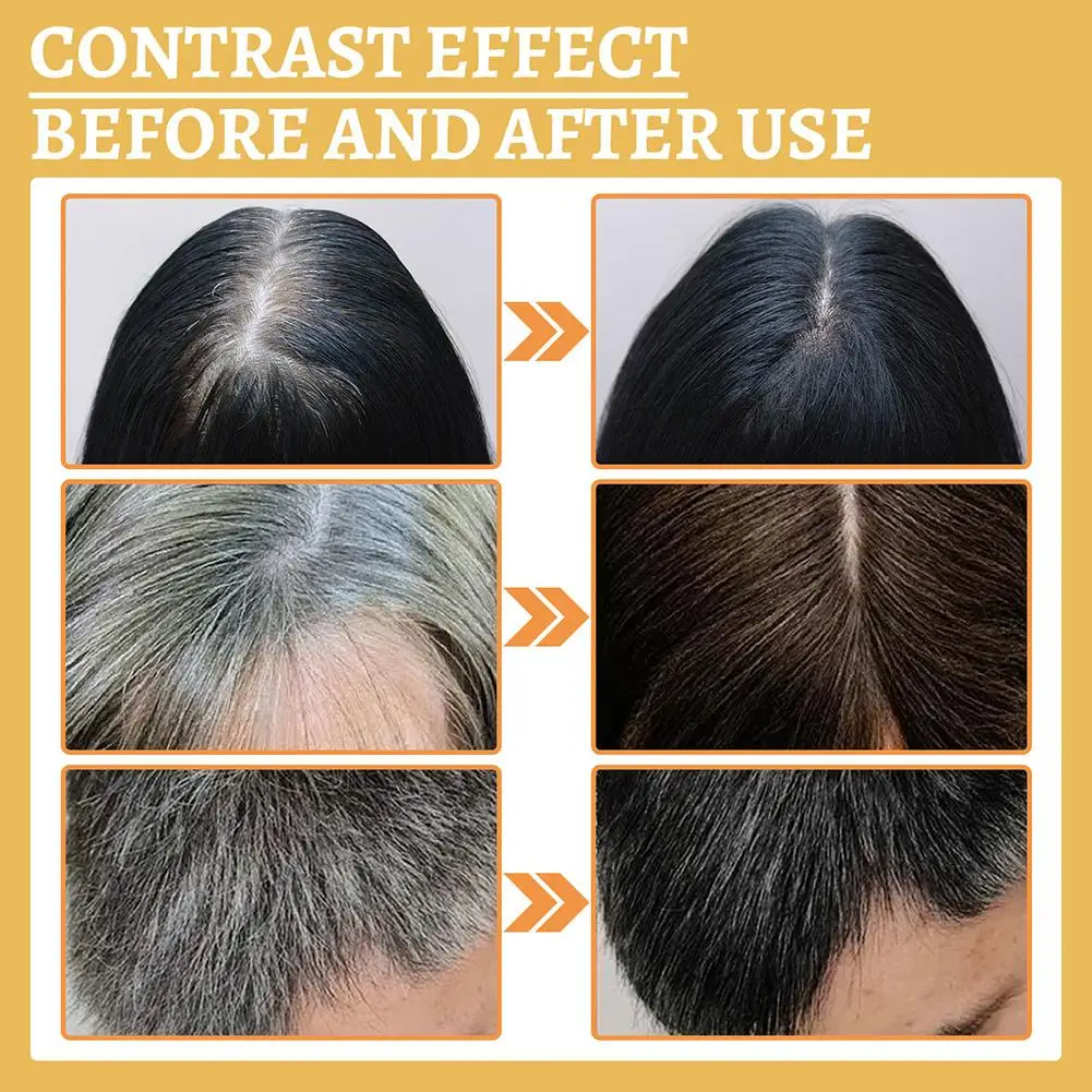 アグリーヘア血清,インフィニティヘア,シガンデマ,経典,天然 - Licorice Root Sticks のレビューと価格