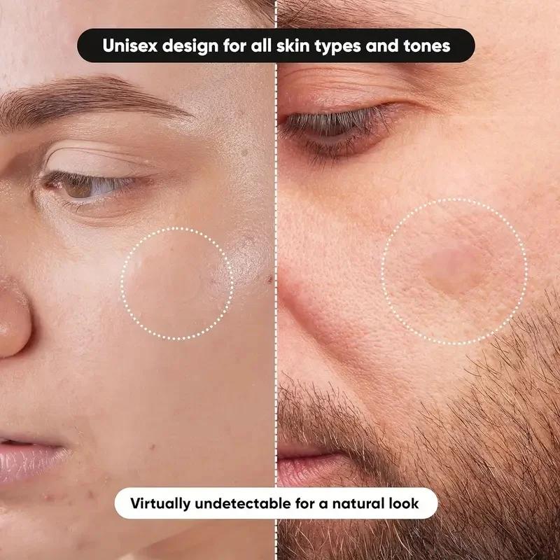 360枚/箱 ニキビパッチ - アルコールフリー、ニキビの分 - Essential Oils のレビューと価格